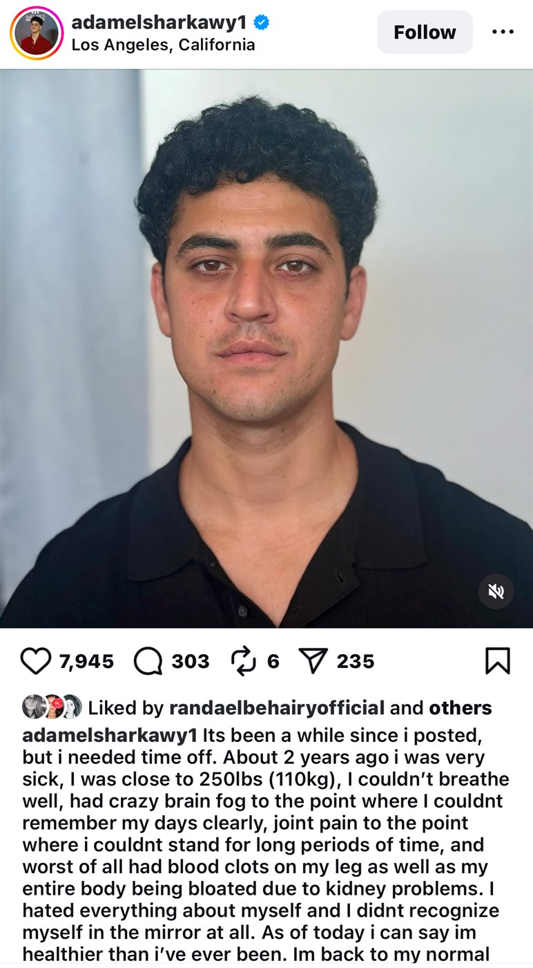 <strong>ادى الشرقاوي&nbsp;</strong>