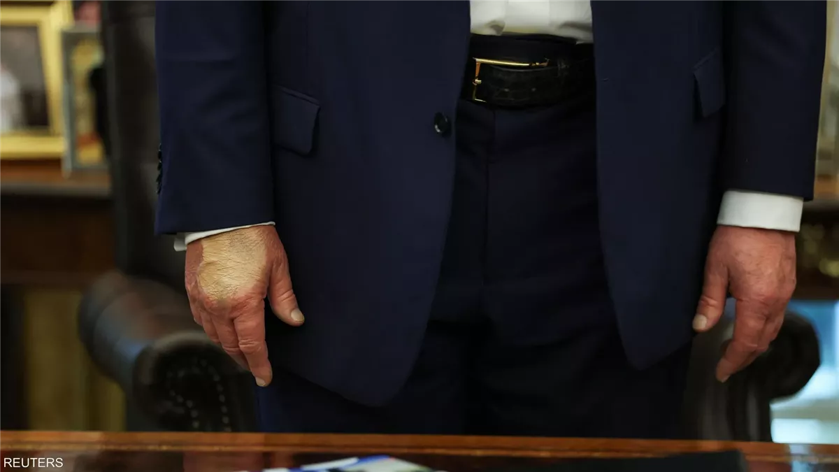 <strong alt=