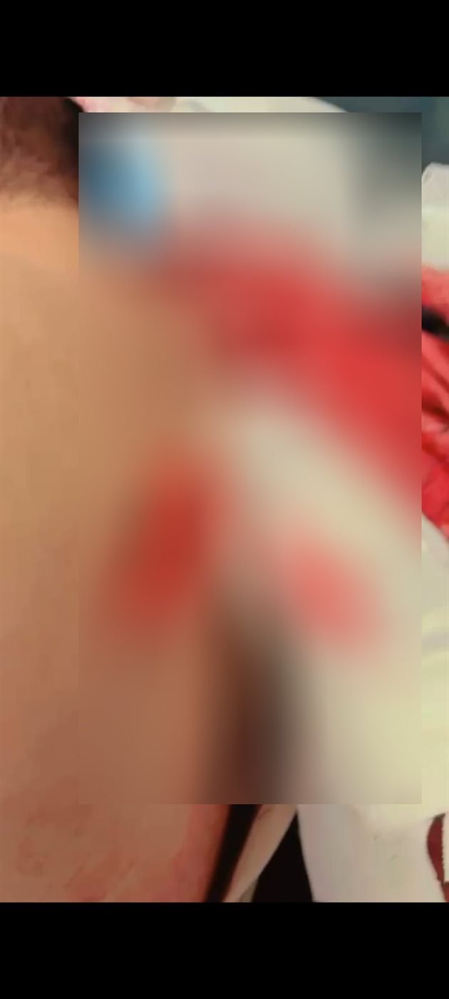 المجنى عليه&nbsp;
