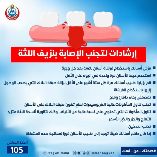 إرشادات لتجنب الإصابة بنزيف اللثة