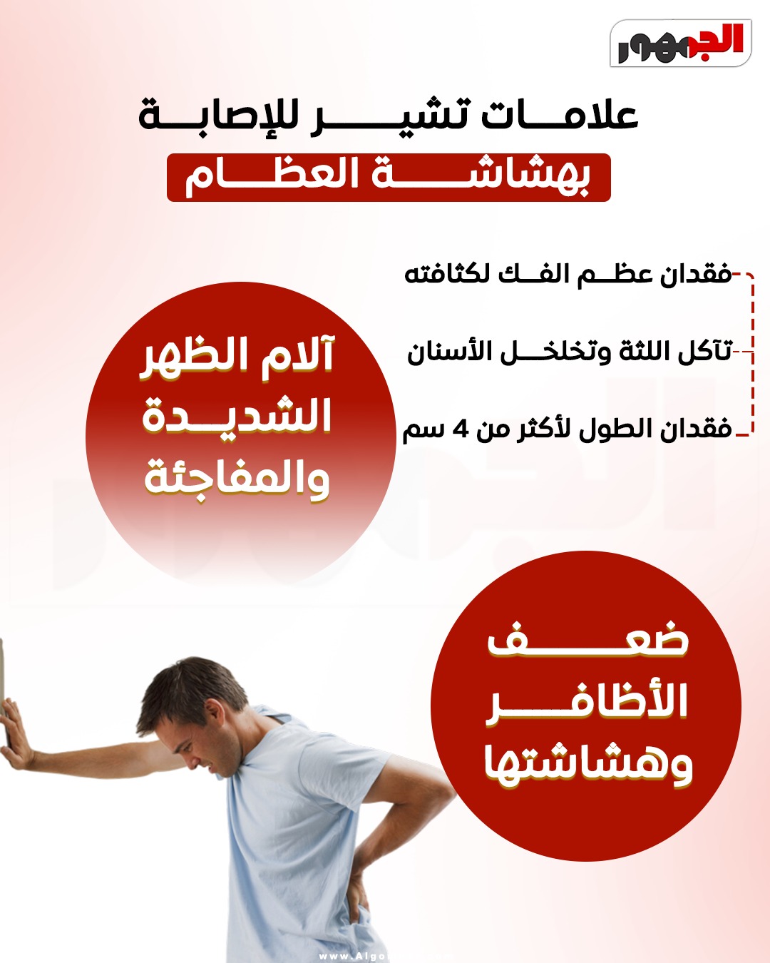علامات هشاشة العظام&nbsp;