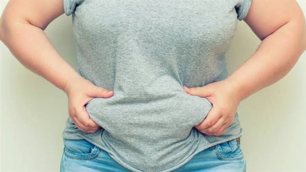 تراكم دهون منطقة البطن