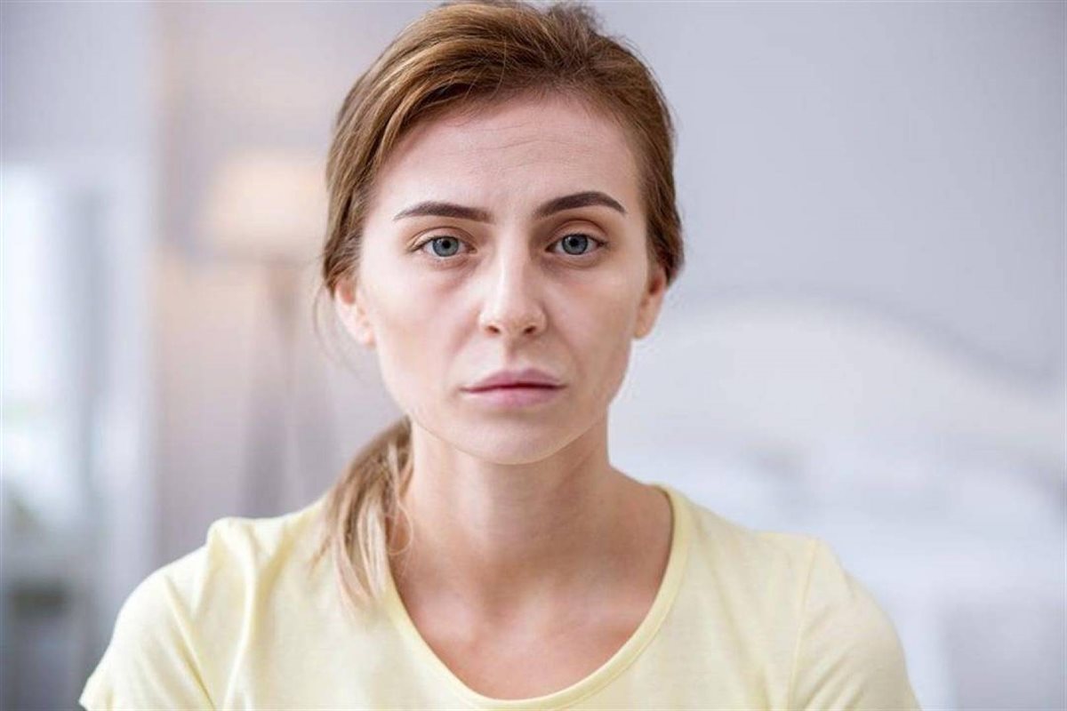 <strong>شحوب الوجه&nbsp;</strong>