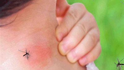 «عضو الحق في الدواء» يكشف لـ «الجمهور» لماذا لا تحتاج حمى الضنك لمضادات حيوية؟