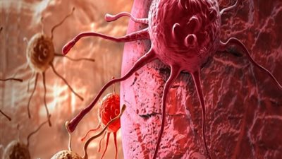 9 مواد شائعة قد تعرّضك للإصابة بالسرطان.. تعرف عليها
