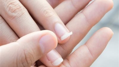 الرطوبة قد تعرضك لتقصف أظافرك تعرفى على الأسباب
