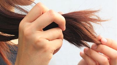 إخصائية تقدم نصائح وقائية لجفاف فروة الرأس