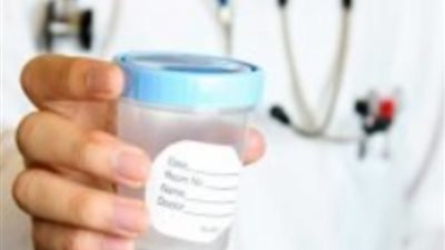 احذري.. تكيس المبايض يؤثر على الإنجاب