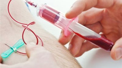 أطعمة تقلل من مستوى الهيموجلوبين في الدم.. تعرف عليها