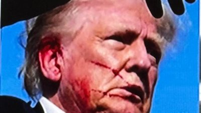 انفراد، ننشر أول صورة لإصابة دونالد ترامب بعد محاولة اغتياله