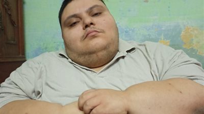 مأساة شاب، رحلة معاناة مع السمنة المفرطة وأمل في حياة جديدة (فيديو)
