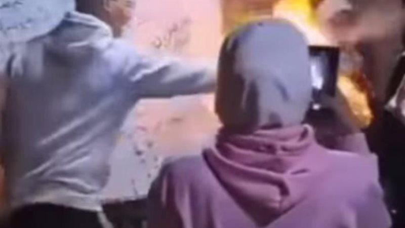 إصابة معلمة بحروق