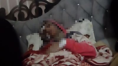 زوج يشوه وجه زوجته بـ «كاتر» في المحلة الكبرى.. والشرطة تتدخل
