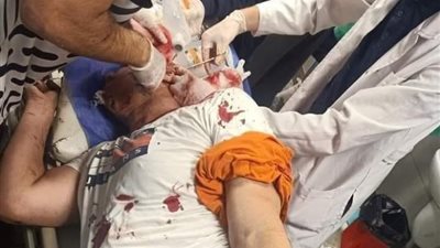 خروج 5 مصابين فى حادث صاروخ طابا واستقرار حالة السادس