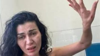 نادين الراسي تحرر محضرًا ضد شقيقها بعد الاعتداء عليها بالضرب