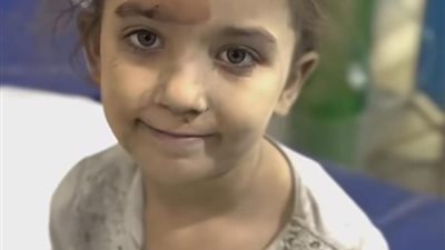 من رحم الألم يولد الأمل.. ابتسامة طفلة مصابة في غزة تشعل مواقع التواصل
