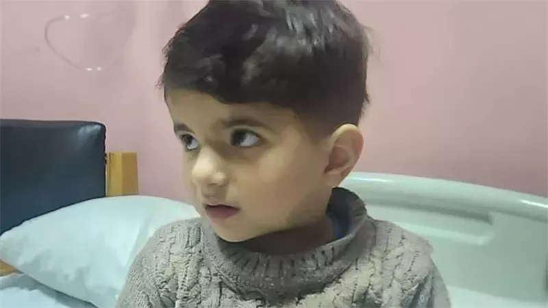 الطفل الذى اجرى العملية