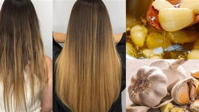  سر إنبات الشعر وقوته.. تعرف على فوائد الثوم