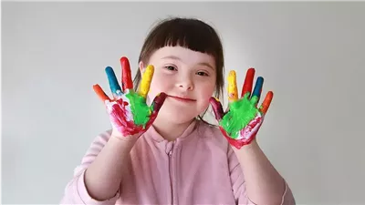 في اليوم العالمي لمتلازمة داون.. معًا لنشر الوعي من أجل مستقبل أفضل