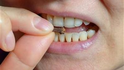 نتائج مذهلة.. ماذا يحدث للجسم عند مضغ القرنفل؟