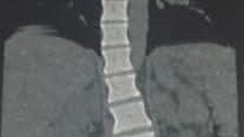الحالة المرضية