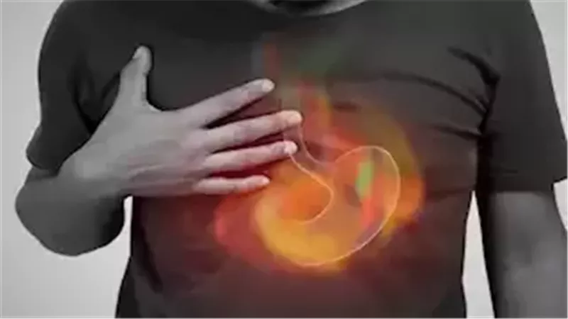 إرشادات لتجنب الحموضة