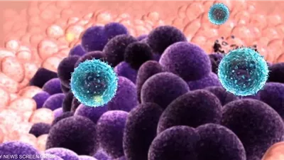 دراسة: ارتفاع معدلات الإصابة بالسرطان للشباب البالغين قبل سن الخمسين