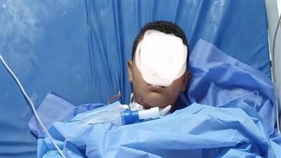 سوهاج الجامعي تنقذ حياة طفل بعد اختراق سيخ معدنى للرقبة والفك (صور)
