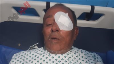 مسئول حماية الأراضي بسوهاج  لـ«الجمهور»: ضربوني «بالبوكس» والنظارة انكسرت في عيني |فيديو