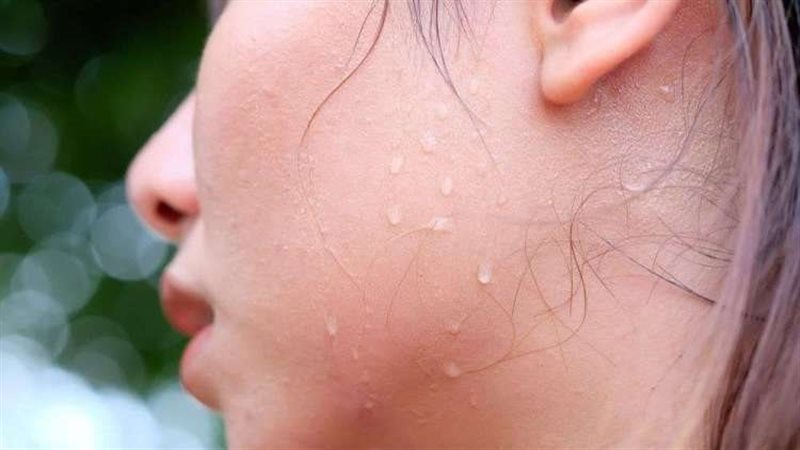 طرق التخلص من تعرق الوجه 