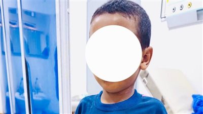 إنقاذ طفل تعرص لطعنة في القلب باستخدام منظار الصدر الجراحي بسوهاج 