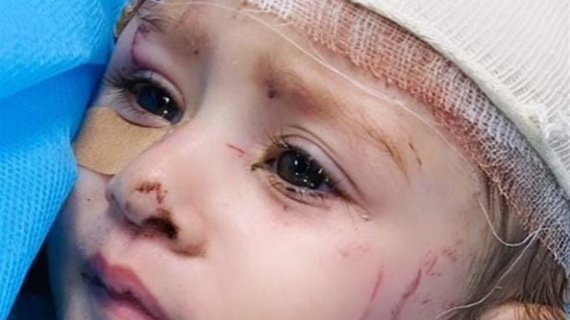 الطفلة الفلسطينية نور عاشور