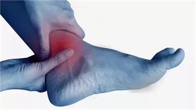 تورم الكاحلين ليس فقط من الوقوف.. اعرف الأسباب وطرق العلاج في المنزل