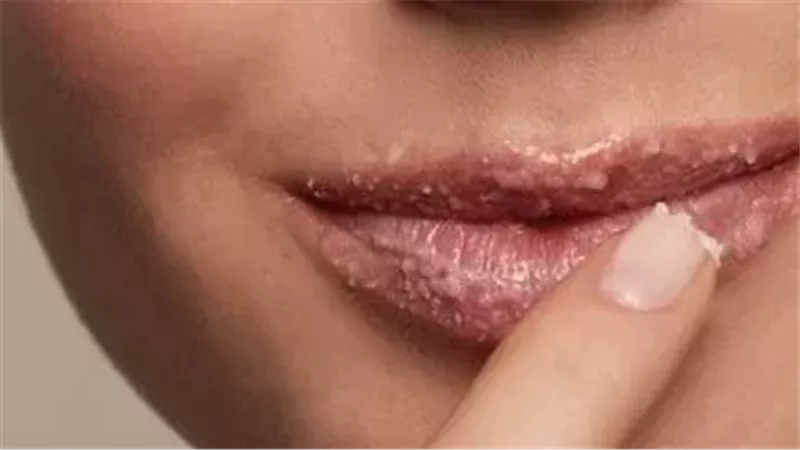 ترطيب الشفاه 