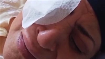 خطأ طبي.. سيدة تفقد عينها داخل مستشفى بالمحلة والنيابة تبدأ التحقيق