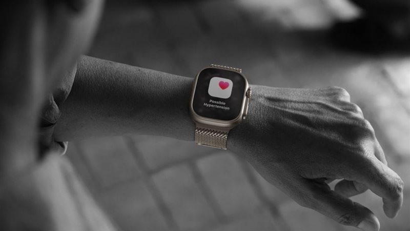 ساعة آبل Watch Ultra 3