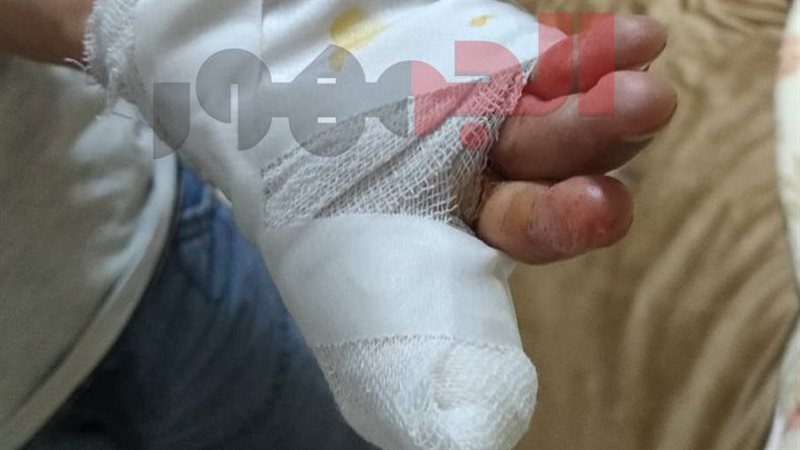 الطفل المصاب