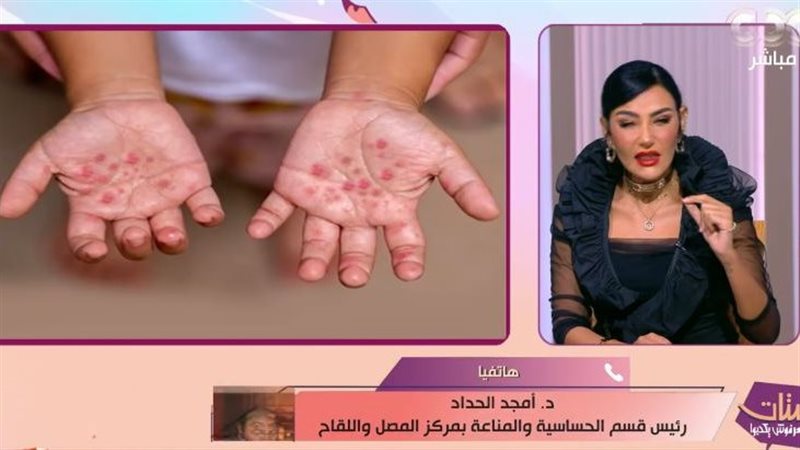 برنامج 