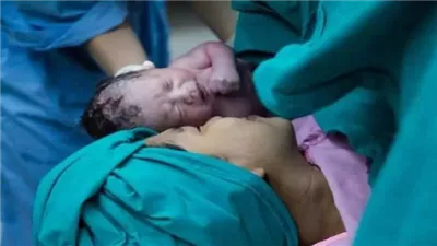 الصحة تحذر: الولادة القيصرية قبل الأسبوع 37 تعرض الطفل لمخاطر الولادة المبكرة