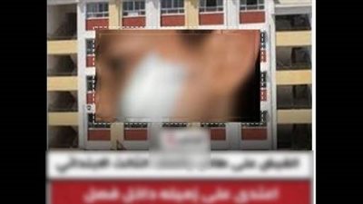 كشف حقيقة اعتداء طالب على زميله بـ«كتر» داخل مدرسة بحلوان