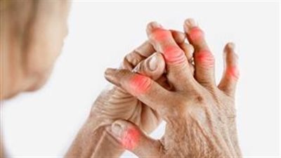 في اليوم العالمي للروماتيزم.. لا تتجاهل آلام المفاصل فالكشف المبكر يُحدث الفرق