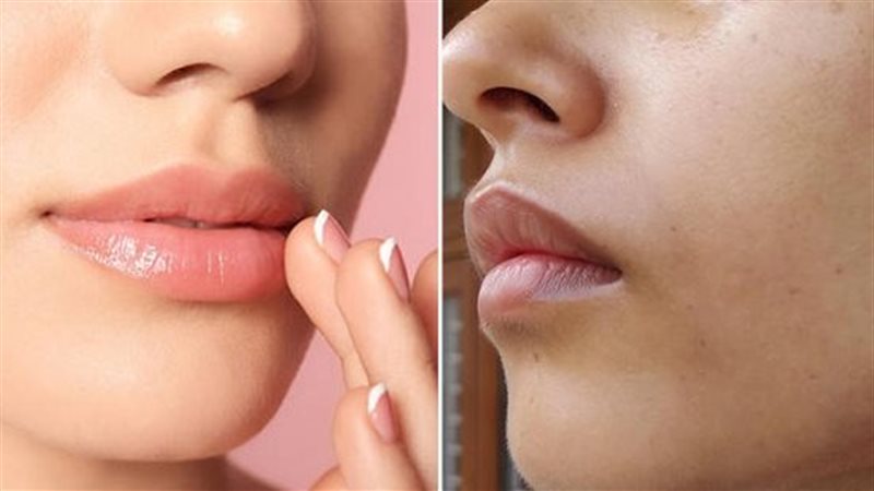 وصفات طبيعية لتفتيح منطقة حول الفم
