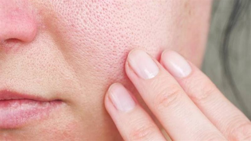 وصفات طبيعية لتضييق المسام