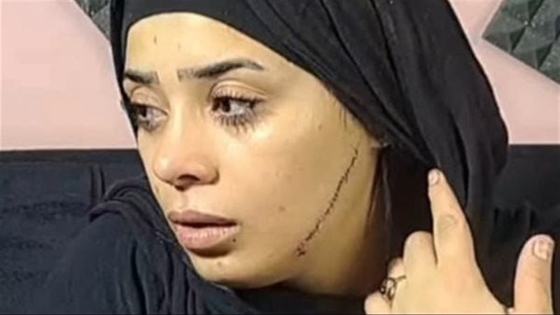 المجني عليها