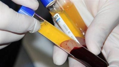 غرامة مليون جنيه عقوبة كل من أدار مركز تجميع الدم بدون ترخيص