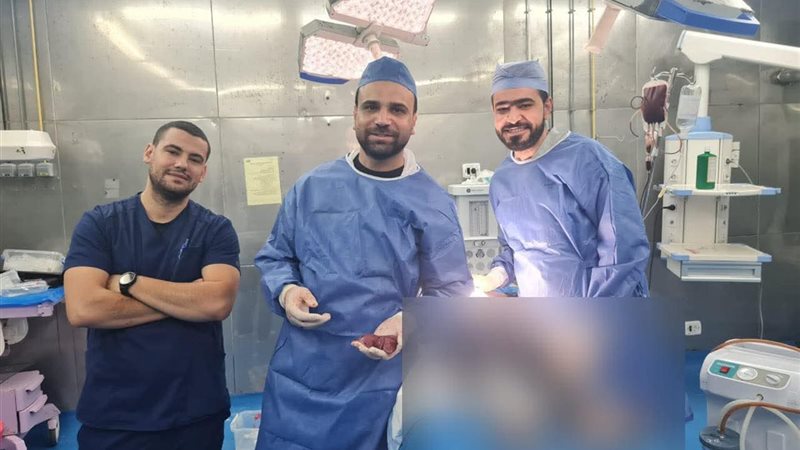 أثناء إجراء العملية