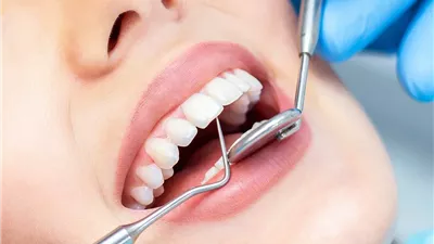  أزمة أعداد خريجي طب الأسنان في مصر.. سوق العمل يتجاوز طاقته الاستيعابية