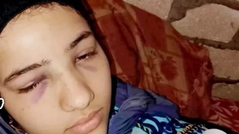 فرحة احدى الناجيات من حادث الطريق الصحراوي 