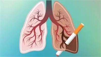     الصحة تحذر: التدخين يهدر طاقتك ويهدد صحة الرئة