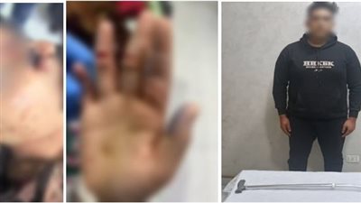 لرفض شقيقها خروجها دون علمه..الأمن يكشف حقيقة فيديو فتاة مصابة بجروح فى الشرقية